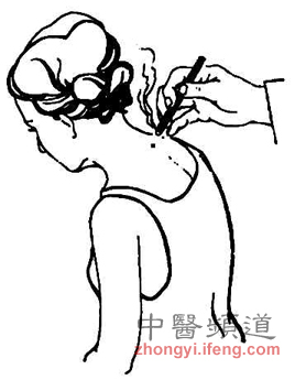 點擊將在新窗口查看全圖 小孩也可以艾灸保健 但要注意5點