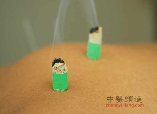 點擊將在新窗口查看全圖 小孩也可以艾灸保健 但要注意5點