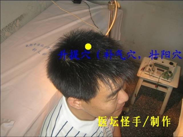 點(diǎn)擊將在新窗口查看全圖 王文遠(yuǎn)平衡針灸穴位圖 - 3396815 - 3396815博愛(ài)