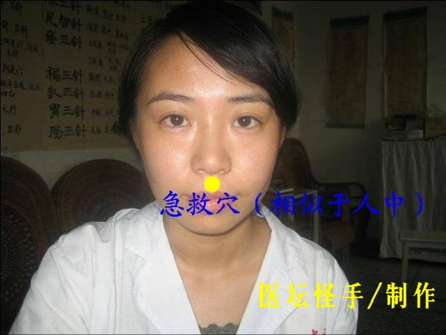 點(diǎn)擊將在新窗口查看全圖 王文遠(yuǎn)平衡針灸穴位圖 - 3396815 - 3396815博愛(ài)