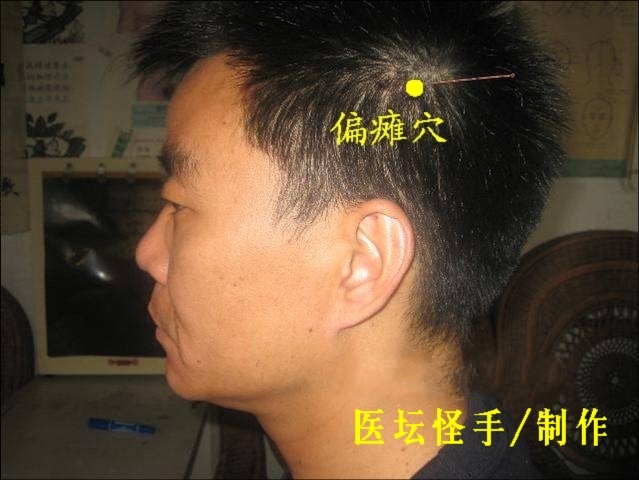 點(diǎn)擊將在新窗口查看全圖 王文遠(yuǎn)平衡針灸穴位圖 - 3396815 - 3396815博愛(ài)