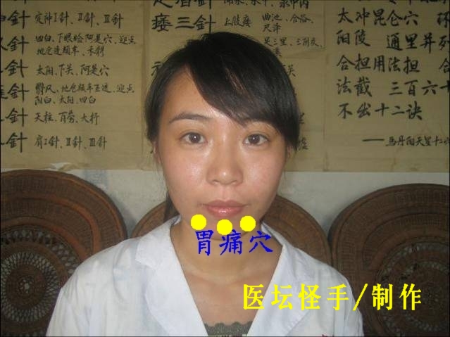 點(diǎn)擊將在新窗口查看全圖 王文遠(yuǎn)平衡針灸穴位圖 - 3396815 - 3396815博愛(ài)