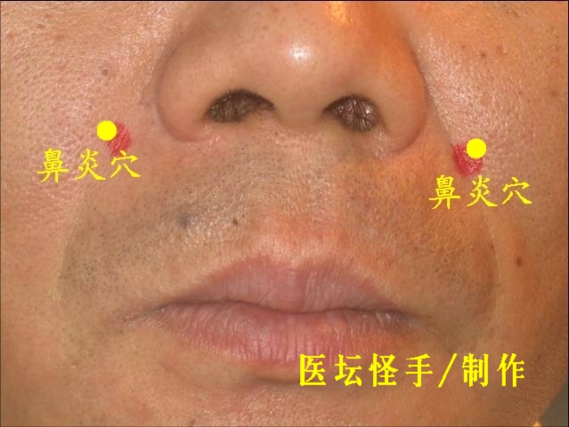 點(diǎn)擊將在新窗口查看全圖 王文遠(yuǎn)平衡針灸穴位圖 - 3396815 - 3396815博愛(ài)