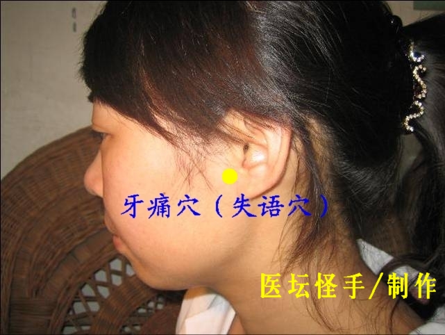 點(diǎn)擊將在新窗口查看全圖 王文遠(yuǎn)平衡針灸穴位圖 - 3396815 - 3396815博愛(ài)