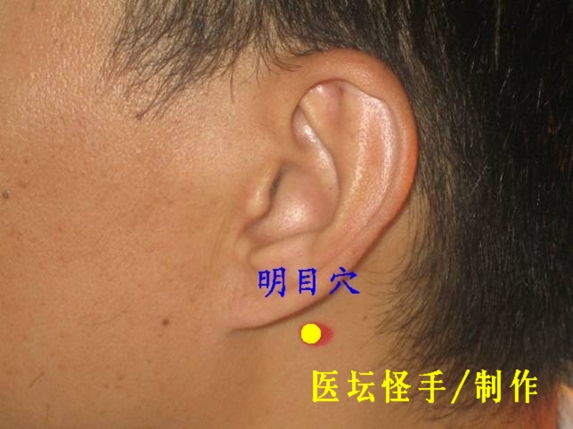 點(diǎn)擊將在新窗口查看全圖 王文遠(yuǎn)平衡針灸穴位圖 - 3396815 - 3396815博愛(ài)