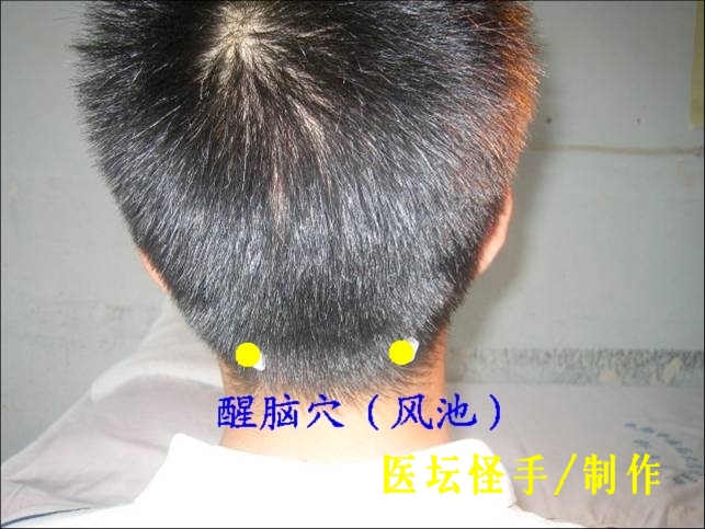 點(diǎn)擊將在新窗口查看全圖 王文遠(yuǎn)平衡針灸穴位圖 - 3396815 - 3396815博愛(ài)