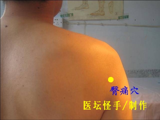 點(diǎn)擊將在新窗口查看全圖 王文遠(yuǎn)平衡針灸穴位圖 - 3396815 - 3396815博愛(ài)