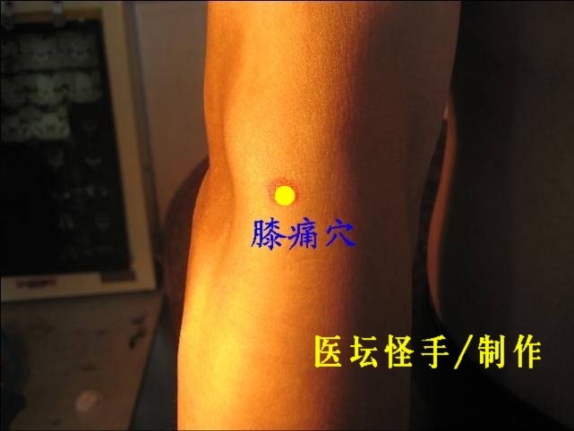 點(diǎn)擊將在新窗口查看全圖 王文遠(yuǎn)平衡針灸穴位圖 - 3396815 - 3396815博愛(ài)