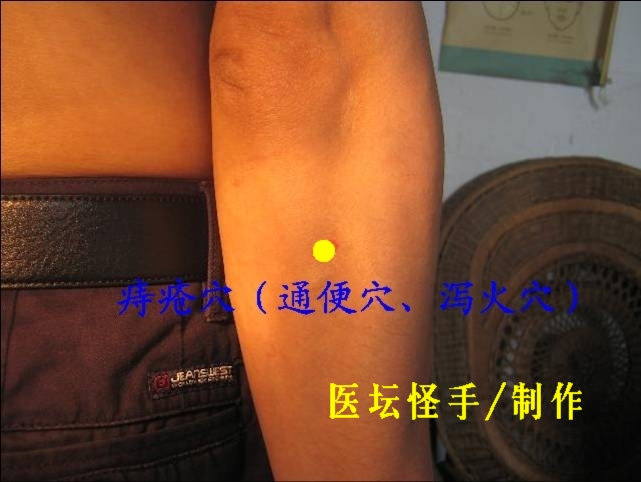 點(diǎn)擊將在新窗口查看全圖 王文遠(yuǎn)平衡針灸穴位圖 - 3396815 - 3396815博愛(ài)