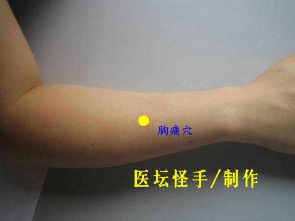 點(diǎn)擊將在新窗口查看全圖 王文遠(yuǎn)平衡針灸穴位圖 - 3396815 - 3396815博愛(ài)